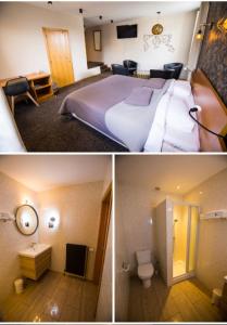巴拉特里乐斯卡佩德酒店的两张图片的酒店客房 - 带一张床和一间浴室